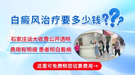 石家庄医院白癜风光疗一次大概多少钱