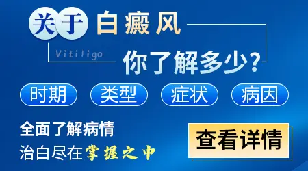 白癜风到底有没有治好的可能性