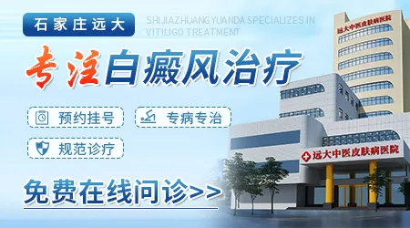 石家庄远大皮肤科医院治疗白斑效果怎么样
