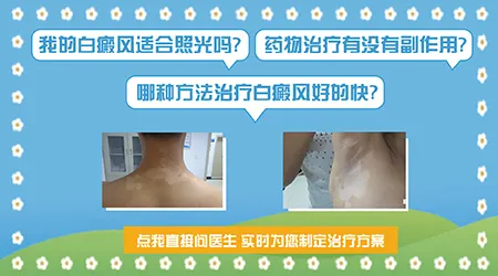 308准分子激光和窄谱UVB有什么区别