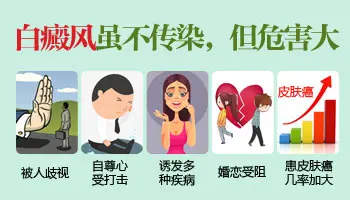白癜风一两个小白点不治可以吗