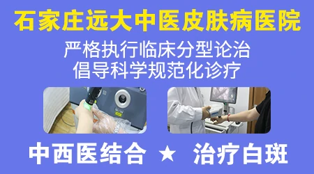 什么样的白斑可以不用治