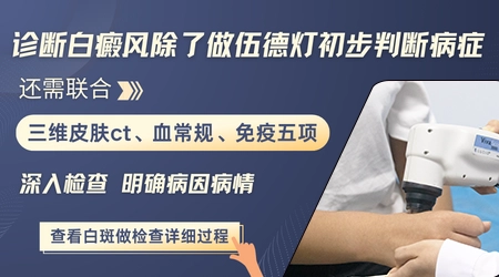 手臂白斑是白癜风吗 自测方法需了解