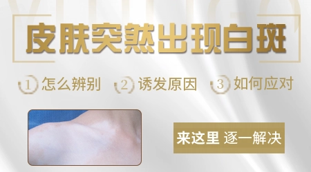 皮肤出现白斑是什么原因