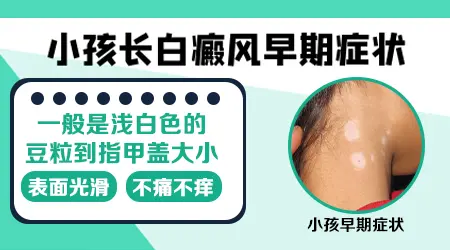 小孩背部长白癜风初期症状图片