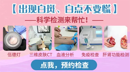 图片对比白癜风和贫血痣的区别
