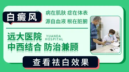 芦可替尼乳膏加照激光能治好白癜风吗
