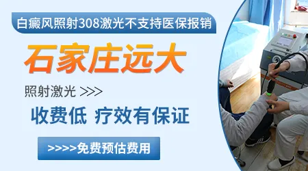 石家庄照308准分子激光价格一般多少