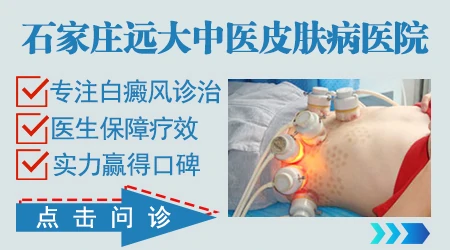 石家庄治白癜风去三甲医院还是专科医院