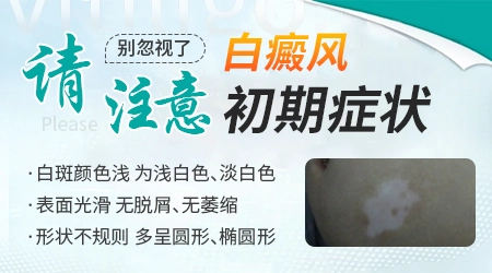 身上长白斑一开始是什么样子的图片