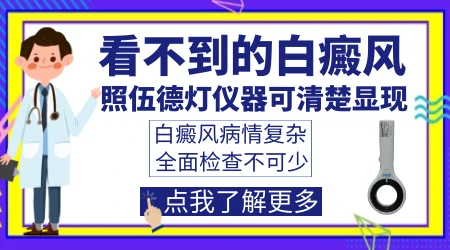 早期小面积白斑伍德灯会不会漏诊