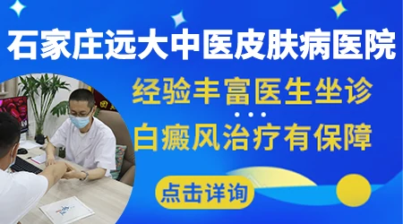 石家庄哪个皮肤科专家治白癜风好