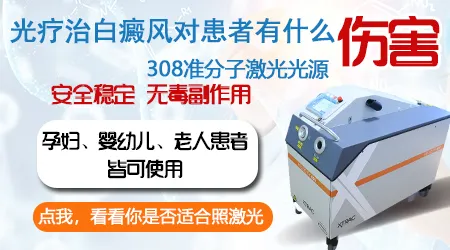 婴幼儿脸上的白斑能照308激光吗