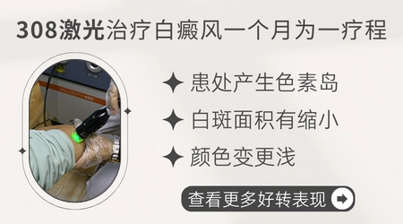 白癜风照射308激光恢复过程症状图片
