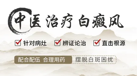 目前白癜风能不能根治