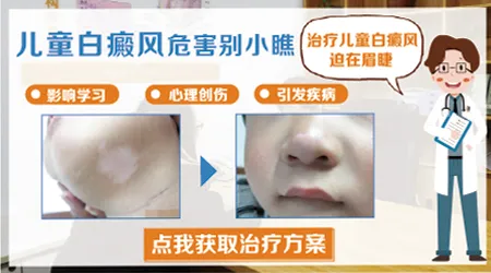 宝宝白癜风初期有什么症状图片