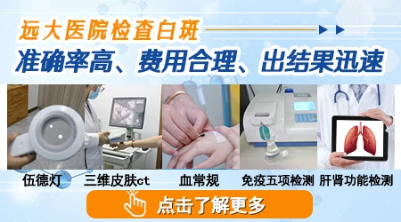 皮肤镜鉴别白癜风的准确率高吗