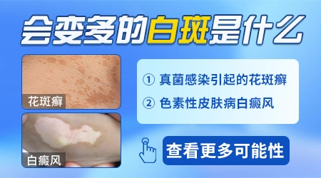 身上出小白点慢慢变大了是怎么回事