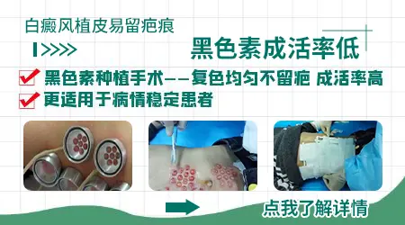 白癜风植皮手术之后会不会留下明显疤痕