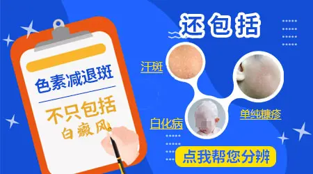 色素减退性白斑和白癜风有什么区别
