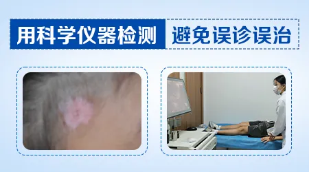 腋下的浅色斑块不痛不痒是什么情况