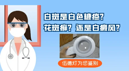 孩子肚子上长一片白斑是什么情况