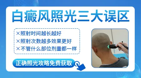 白癜风进展期做光疗会不会导致白斑扩散