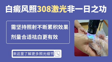 白癜风照射308激光恢复过程症状图片