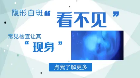隐形白斑在伍德灯下什么样图片