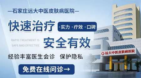 石家庄治疗儿童白癜风好的医院