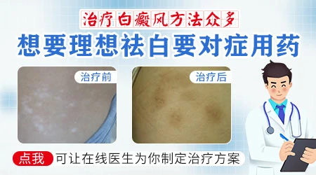 小女孩脸上有一小块白是怎么回事