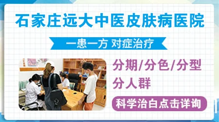 石家庄皮肤病医院哪个看白癜风好