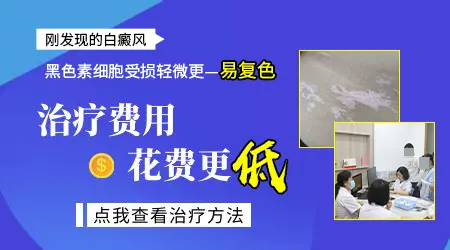白癜风治疗的总费用大概要花多少钱