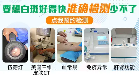 伍德灯检查白斑的准确率多少