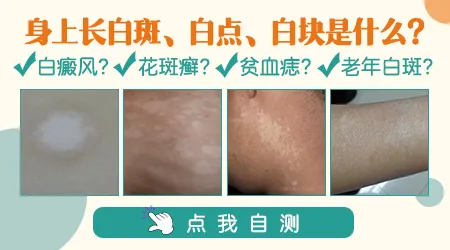 脸上出现好多白斑怎么回事