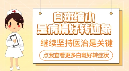 白癜风治好的希望有多大