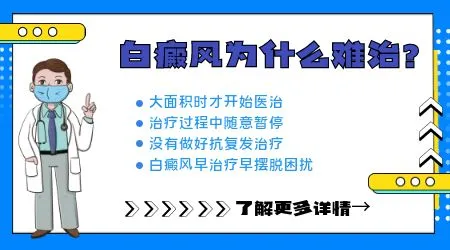 白癜风长在手上为什么恢复得慢