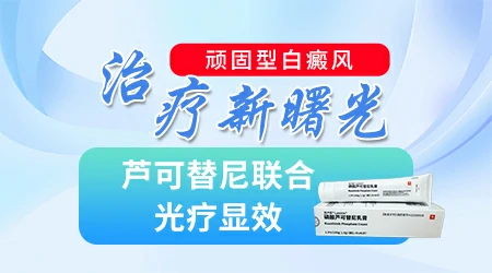 白癜风单药遇瓶颈怎么办 -芦可替尼联合光疗，让难治部位"跟上来"