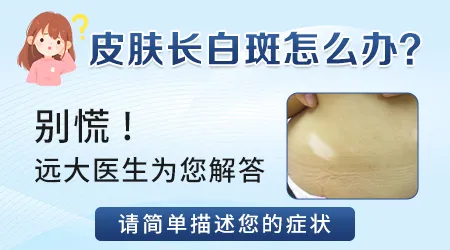 云白色的白斑是不是白癜风