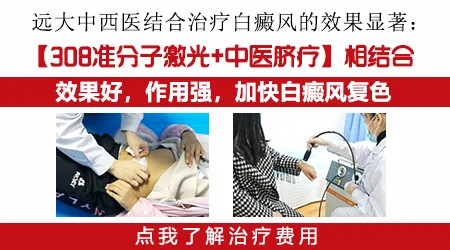 石家庄哪个中医看白癜风效果好