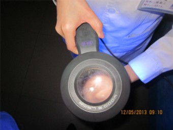 紫外线灯检测白斑