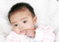 婴儿白癜风早期症状是什么