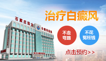 多少钱可以治疗好白癜风