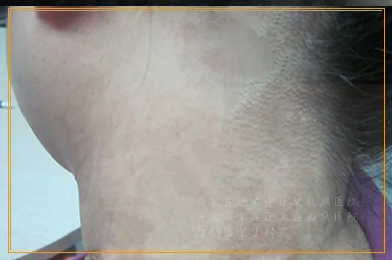 照308出现耐光是不是所有的光都会耐啊