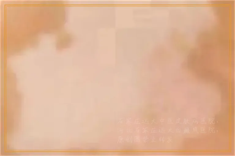 孩子后脑勺的位置有一块白斑要紧吗