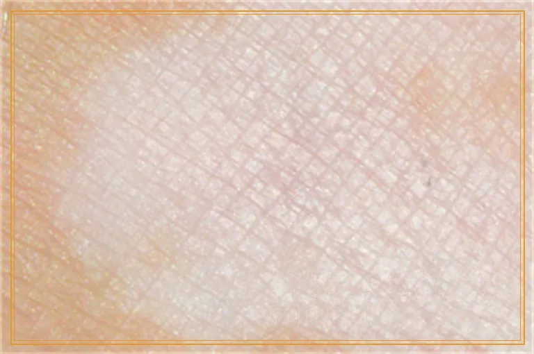 额头上有米粒大的小白点怎么回事