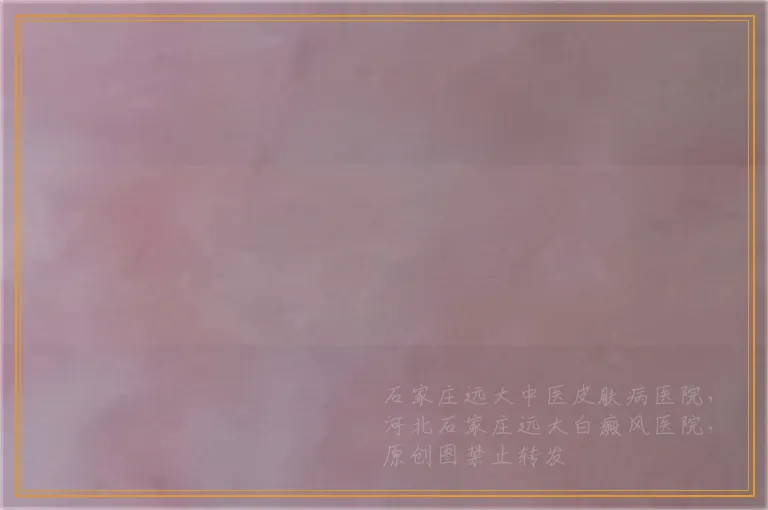 下眼皮有小白点去医院要做哪些检查