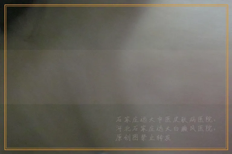 额头出现一块钢镚大的白皮肤咋回事