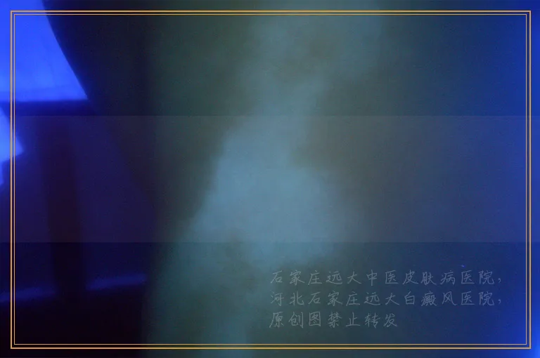 背部长白斑在慢慢扩大是怎么回事