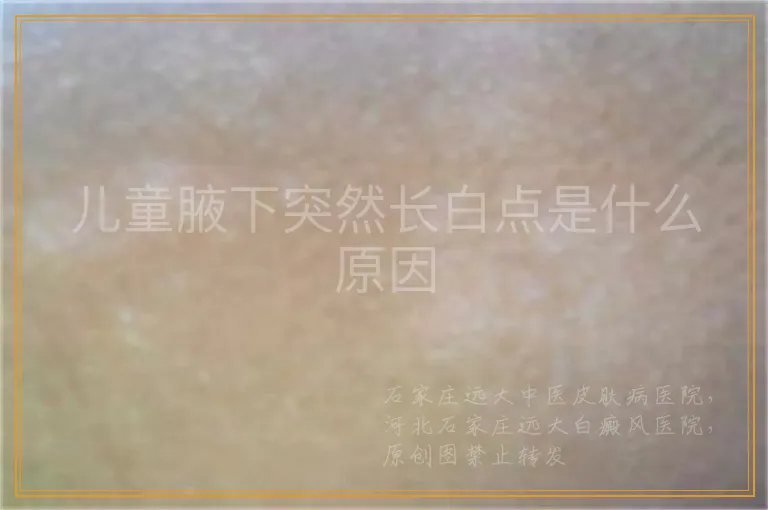 儿童腋下突然长白点是什么原因